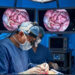 Decision-Making in Cerebellar Tumors: Why the First Plan Isn’t Always the Right One