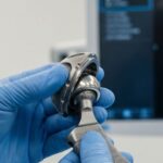 Hip Replacement Surgery in Türkiye for British patients